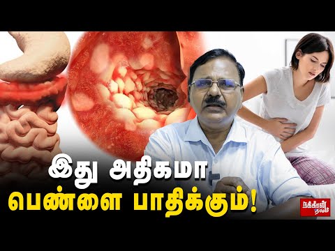 இளைஞர்களை அதிகமாக பாதிக்கும் குடல் நோய்! Dr Rajendran | IBD | Youngers | stomach pain |
