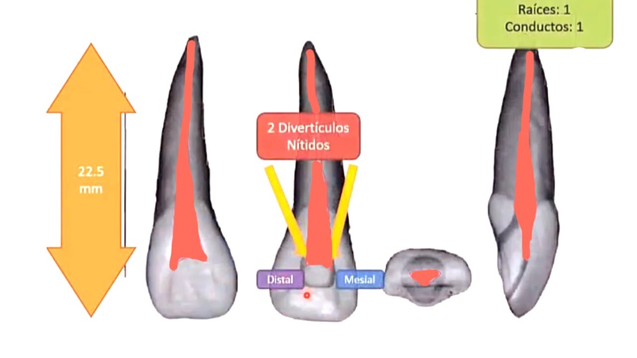 anatomía endodóntica