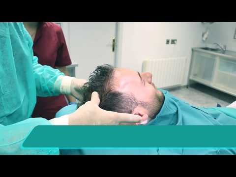 Video: Turniket Na Vlasy: Co To Je, Příznaky, Obrázky A Léčba