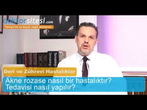 Akne rozase nasıl bir hastalıktır? Tedavisi nasıl yapılır?