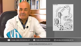 PARASITOSIS INTESTINAL | DR. JORGE GAUNA