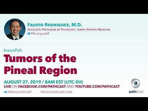 Video: Pinealoma Atau Tumor Pineal: Gejala, Penyebab, Diagnosis, Pengobatan