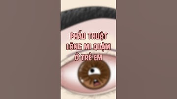 Phẫu thuật lông mi quặm ở trẻ ! #hoathinhbox #kienthuc #learnontiktok #ykhoa #hhbx