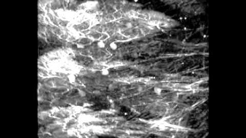 Purkinje Cells of the Cerebellum by Dr. Bernd Kuhn