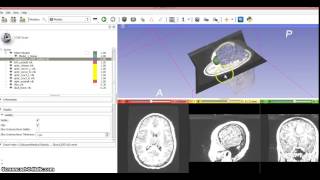 fl7160 3D Slicer Assignment 2 - Working with explanantion.