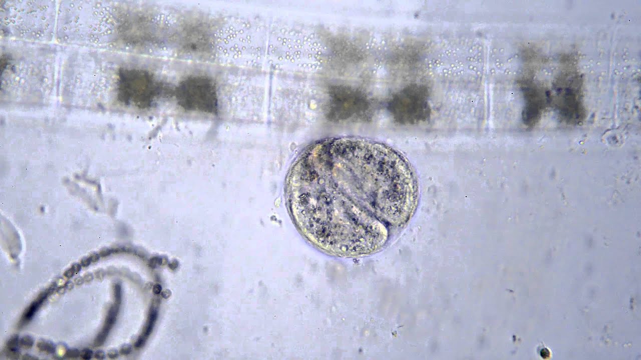 Spannend: Teilung, das Pantoffeltierchen,..ein Sehgenuß !