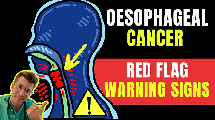 Warning signs & symptoms of OESOPHAGEAL(AKA esophageal /gullet) CANCER - Doctor O'Donovan explains - DayDayNews