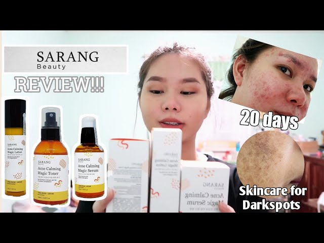 18 Days Using SERUM | BYE DARK SPOTS AT PIMPLE MARKS?? + Sarang Beauty skincare REVIEW class=