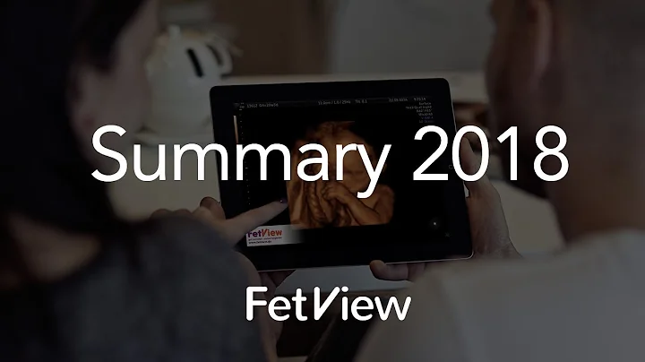 FetView Summary 2018 by CEO David Dostal