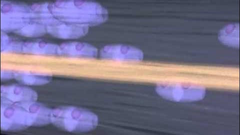 How Mercury Causes Brain Neuron Degeneration - University of Calgary