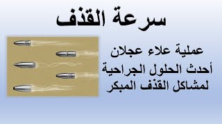 دكتور علاء عبد العزيز عجلان و شرح كامل لعملية علاج سرعة القذف نهائيا حلقة 581