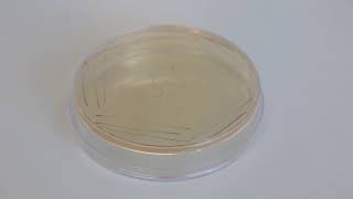 Bacterial Isolation on Petri Dish   Biology Lab Techniques