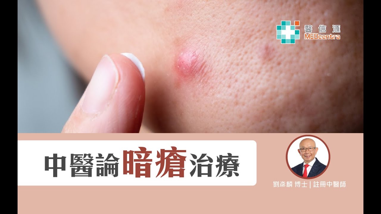 【中醫概念】中醫論暗瘡治療 | 註冊中醫師 劉彥麟博士 - YouTube