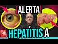🦠 HEPATITIS A Alarma Por AUMENTO DE CASOS 🚨 - Oswaldo Restrepo RSC