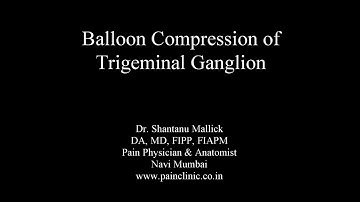 Balloon compression of Trigeminal Ganglion