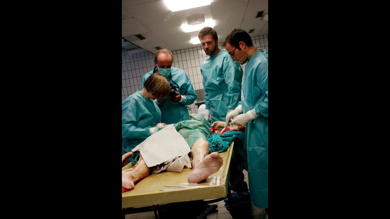 👉 GUPIMISHA UMURAMBO 📌(autopsy)Sobanukirwa service za RFI(RWANDA FORENSIC INSTITUTE)