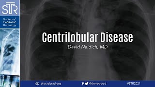 HRCT: Centrilobular Disease