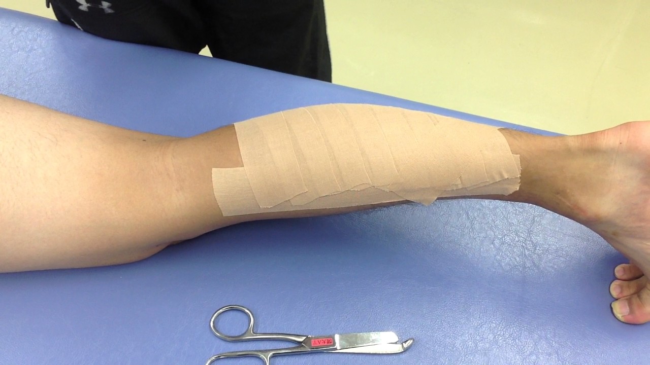 動画で学ぶ ふくらはぎ肉離れテーピング Calf Strain Tape Youtube