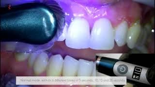 Refine Medical Swan Dental Curing Light Unit Operation & Application