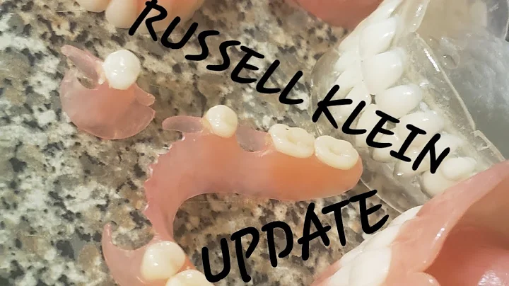 RUSSELL KLEIN UPDATE