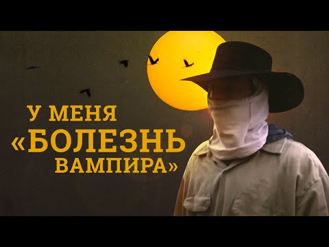 «Болезнь вампира». Эти люди вынуждены избегать солнечного света