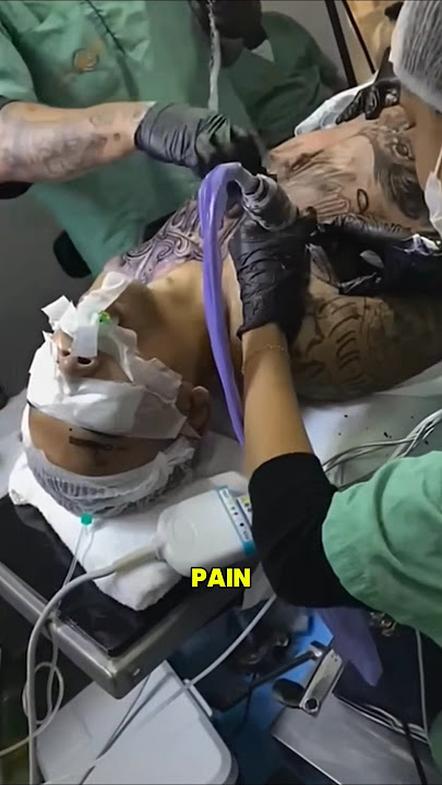 full body tattoo under anesthesia.