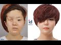 Shy korean girl with facial deformity transforms into a beautiful lady through plastic surgery