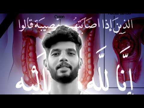 5 أعراض تجاهلها الكثيرون وكانت سبب رحيل إبراهيم شيكا سرطان المستقيم