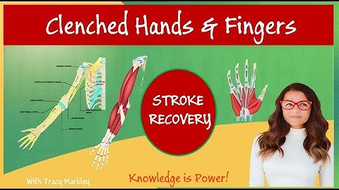 Stroke Recovery Hand Clench & Finger Movement Help | Simple Exercise for Stroke Survivors