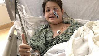 'Miracle' as boy survives fall onto BBQ skewer which impaled his skull