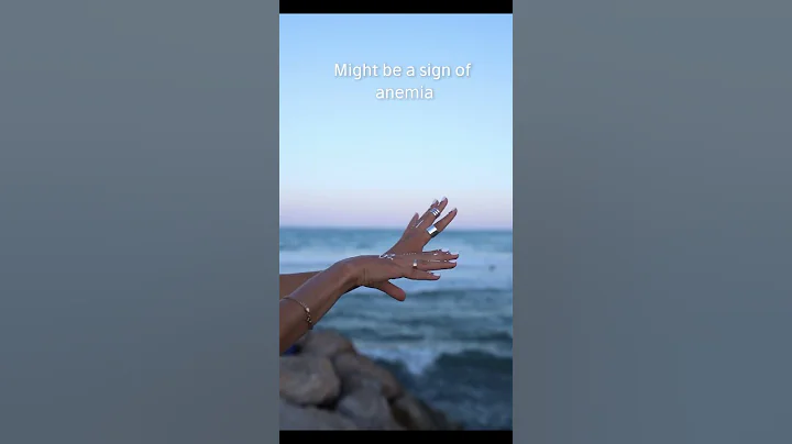 Your nails are a reflection of your overall health #shorts  #beauty #facts