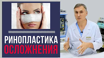 РИНОПЛАСТИКА: 🆘Осложнения | Чего бояться пациенту?