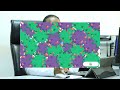 VIRAL HEPATITIS NA PROF HYASINTA JAKA PART 1 VIRAL HEPATITIS NA PROF HYASINTA JAKA PART 1