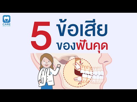 5 ข้อเสียของ ฟันคุด