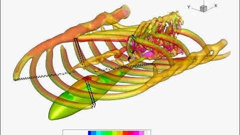 Viscous Vortex Particle For Conventional Rotorcraft