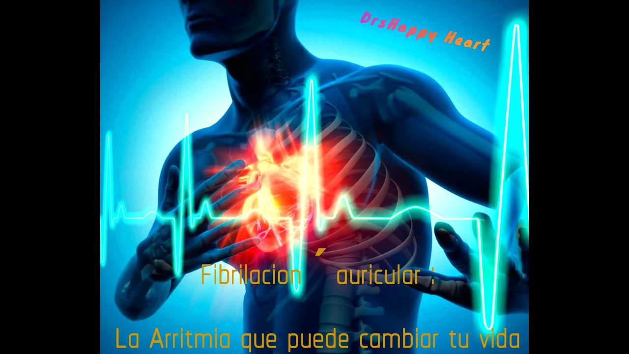 Fibrilación Auricular: La Arritmia que Puede Cambiar tu Vida ⚠️