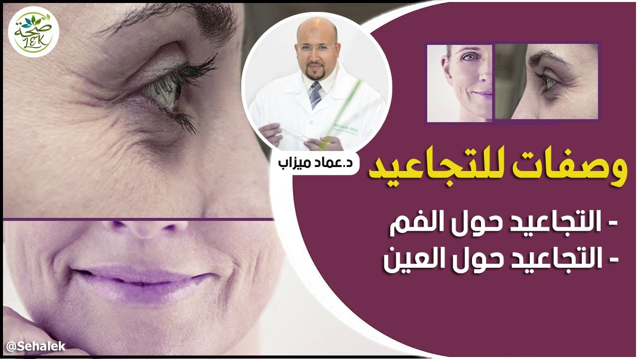 وصفات التجاعيد / تجاعيد حول الفم وحول العينين / wasafat imad mizab