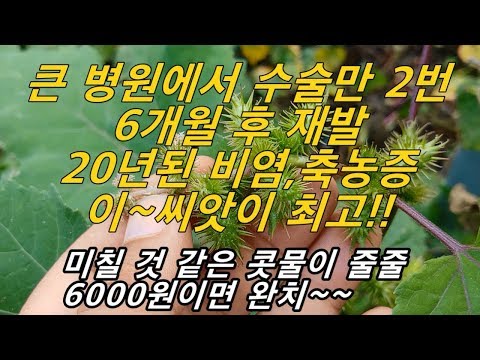 흔한 이~씨앗은 별짓을해도 못 고친 30년된 비염환자를 편하게 숨 쉬게한 최고의 명의사!!