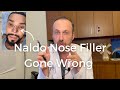 Nonsurgical rhinoplasty expert  avoid skin necrosis  rivkin aesthetics dr alexander rivkin