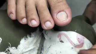 Pedicure 