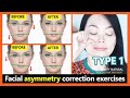 (Type 1) How to fix asymmetrical face, get a symmetrical face naturally. Facial asymmetry exercises.