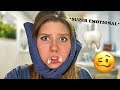 WISDOM TEETH REMOVAL SURGERY AFTERMATH | Totally Taylor