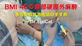 【業者裁断済】胸部硬膜外麻酔 : ビジュアルに解説するMLA 裁断本】胸部硬膜外麻酔 : ビジュアルに解説するMLA 胸部硬膜外