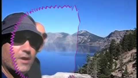 Scintillating Scotoma