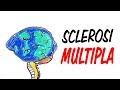 Sclerosi Multipla: che cos&#39;è?