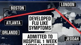 MERS virus threat: CDC racing to find those possibly exposed