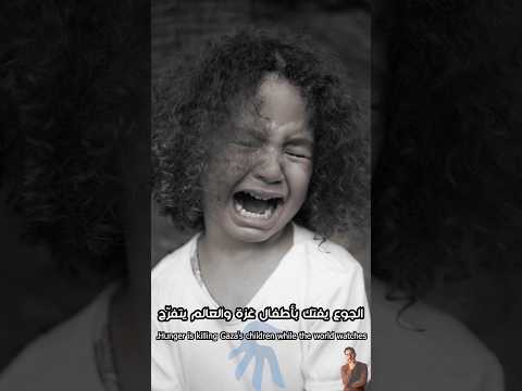 حين يصبح موت الأطفال جوعا