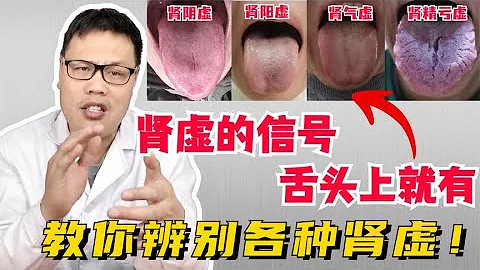 腎虛的信號，舌頭上就有，教你辨別陽虛、陰虛各種腎虛！   【舌診案例分析】 - 天天要聞