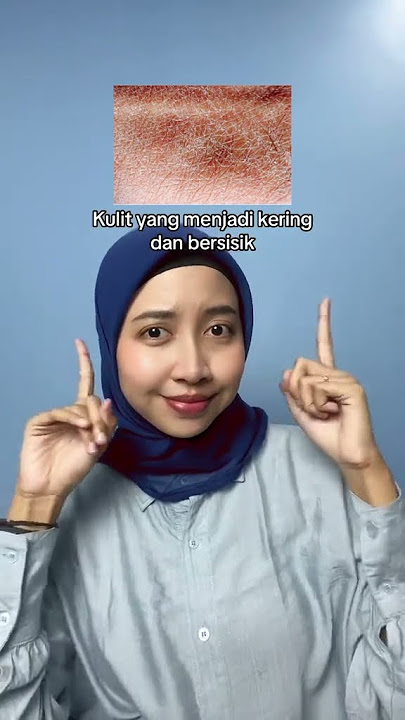 Ciri Kulit Gatal Karena Eksim