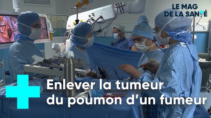 Cancer du poumon : une chirurgie de précision - Le Magazine de la Santé